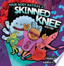 Your_body_battles_a_skinned_knee